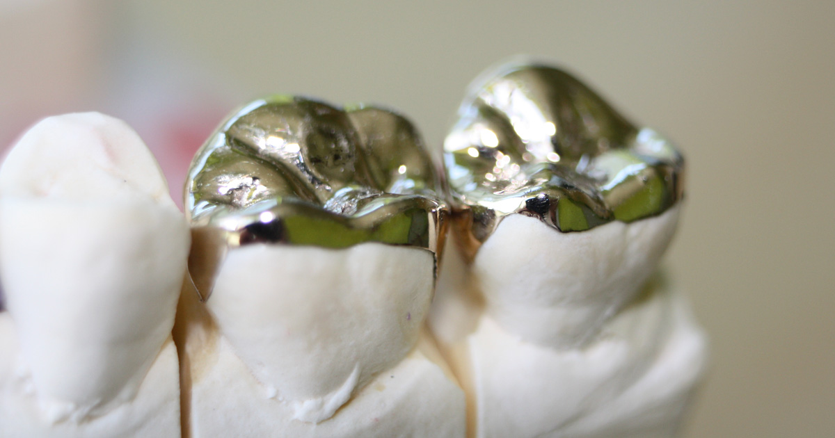 Gold crowns
