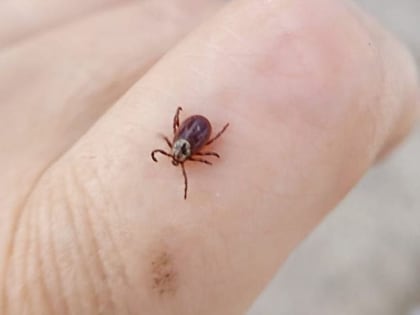 В Лениногорске зафиксирован первый случай укуса клещем жителя города