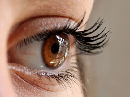 Дерматолог рассказала об опасности наращивания ресниц