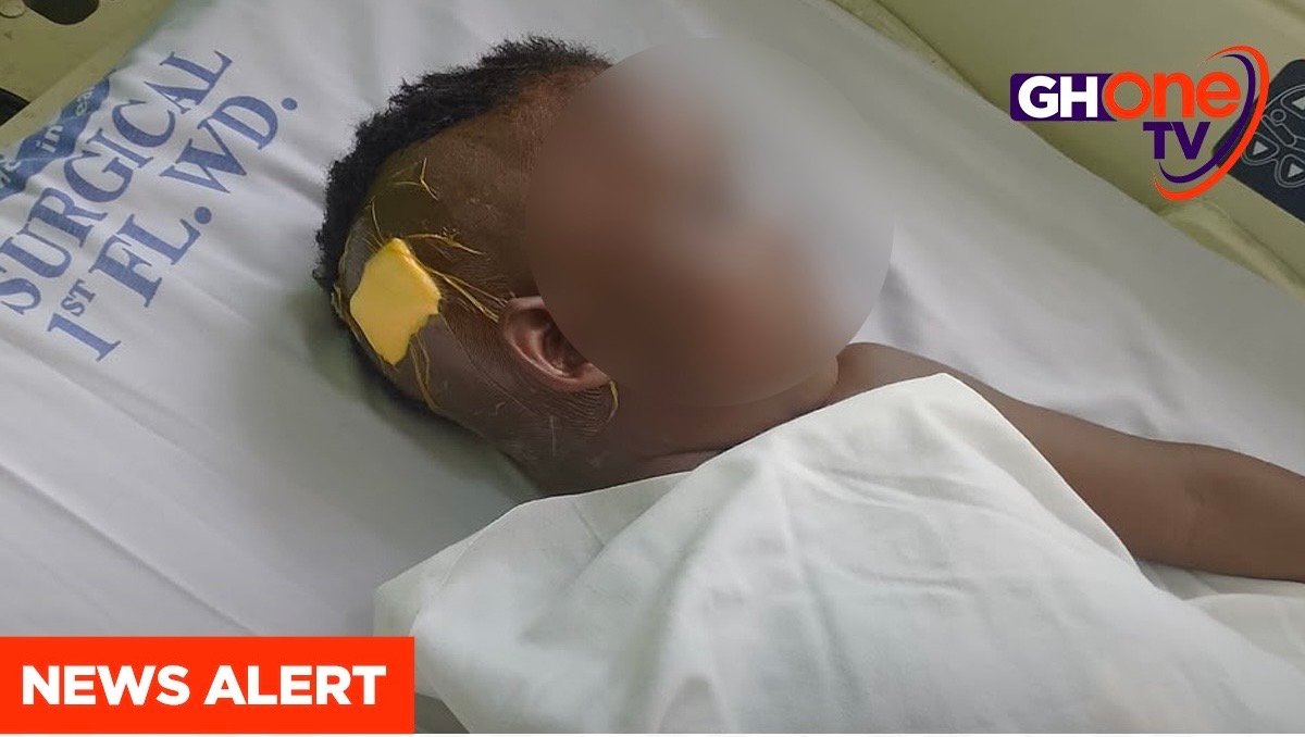 Nkawkaw family seeks funds for life‑saving brain surgery for 5‑year‑old Joycelyn Amoako