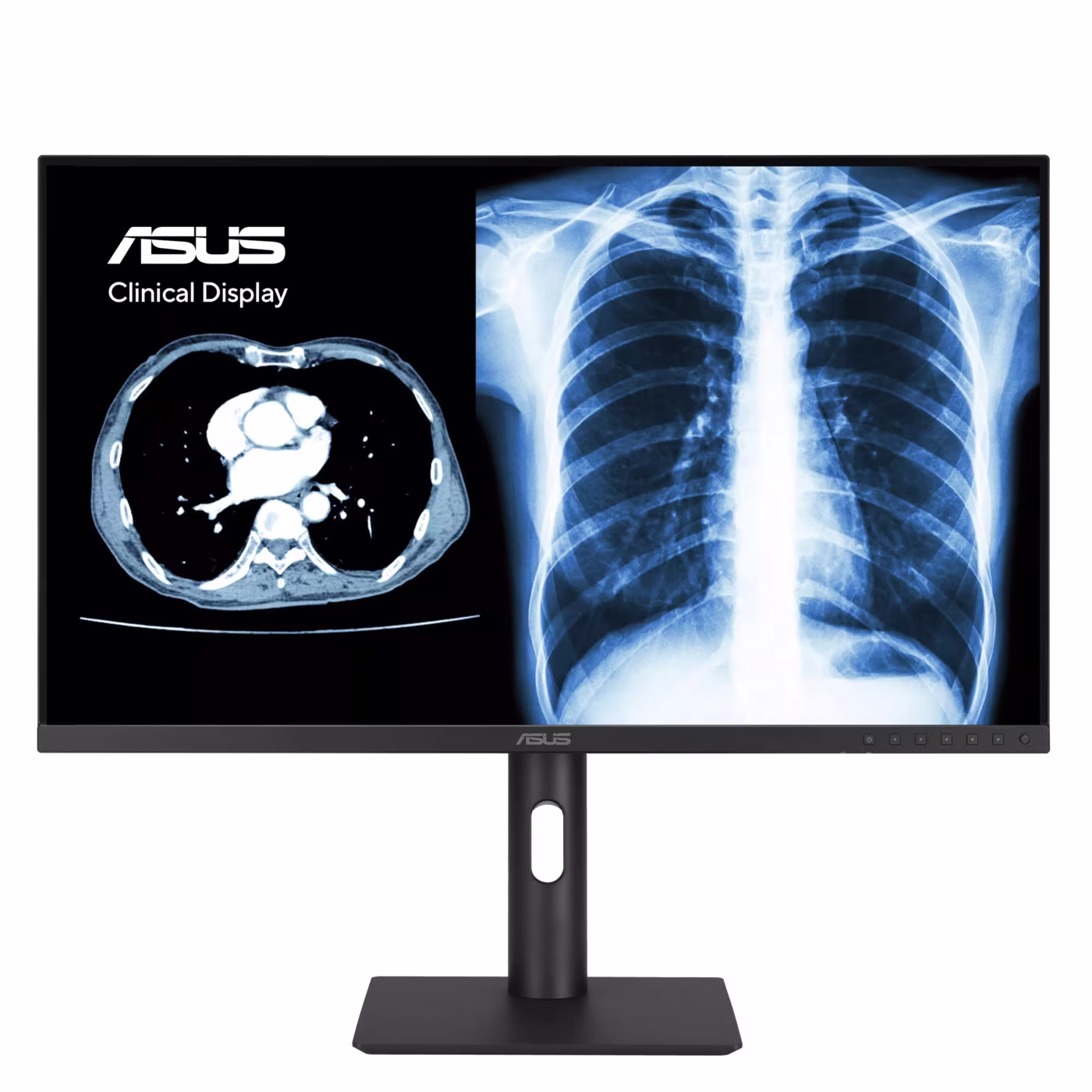 ASUS MH2441A 23.8" QHD IPS Klinik Monitör DICOM - 2