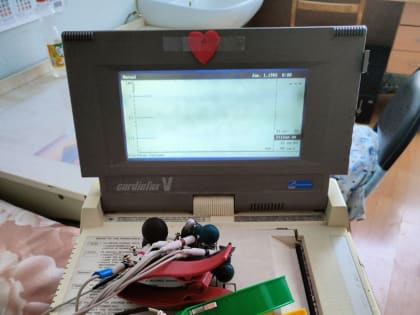 В 2022 году медики предотвратили инфаркт у 30 пациентов