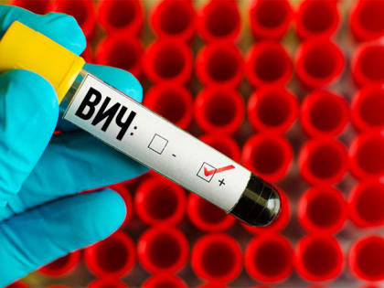 Полевчане могут пройти экспресс-тест на ВИЧ