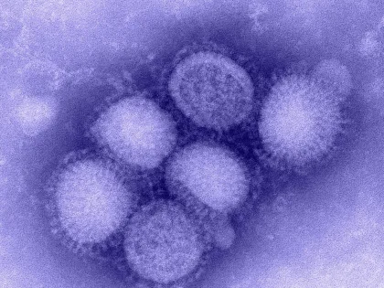 В 2025 году России угрожает свиной грипп H1N1