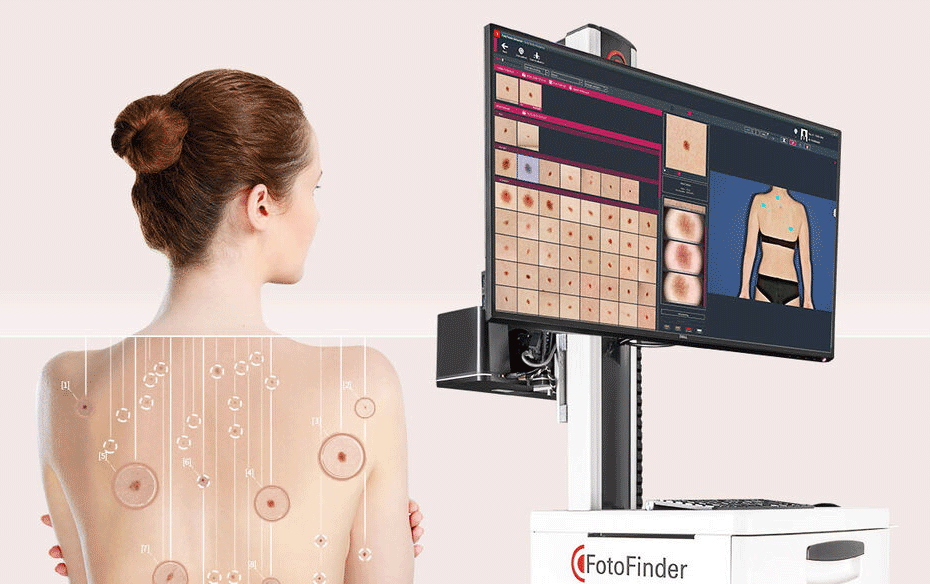 FotoFinder