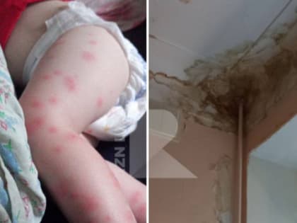 Минздрав отреагировал на жалобу рязанки на условия в детской больнице №9