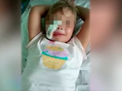 В Крыму лошадь изувечила лицо 4-летней девочки