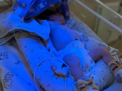 Успешное лечение девочки с тяжелой гемолитической болезнью в Рязани