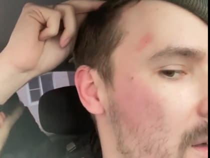 Неизвестный избил рязанца в его машине