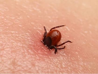 В Рязанской области за неделю от укусов клещей пострадали двое взрослых и один ребенок