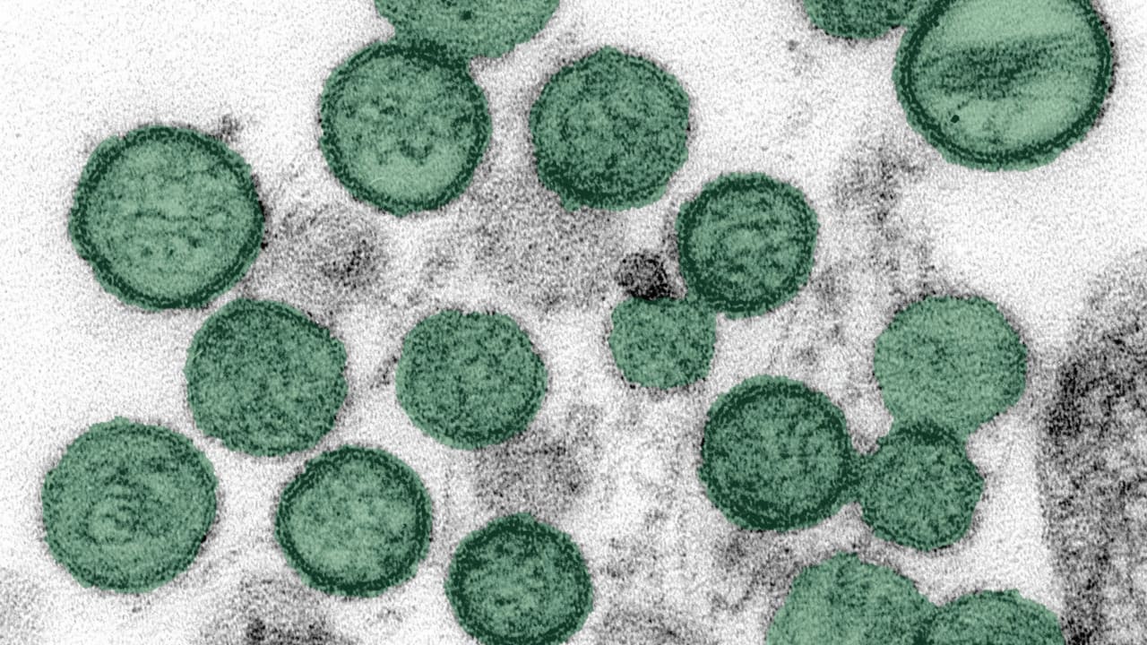 Mutation Fears Rise as New Hantavirus Case Hits Europe