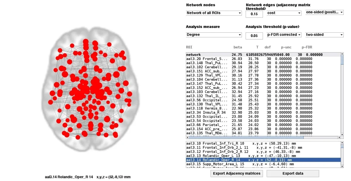 I will preprocess your fMRI data and build functional brain networks - Research Decode Consultancy Cover Image