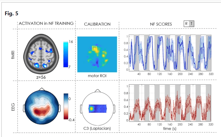 fMRI & EEG Data Interpretation for Clinical Research - Research Decode Consultancy Cover Image