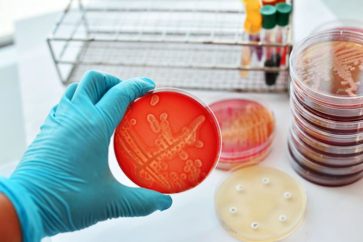 Antimicrobial & Biofilm Assays - Research Decode Consultancy Cover Image