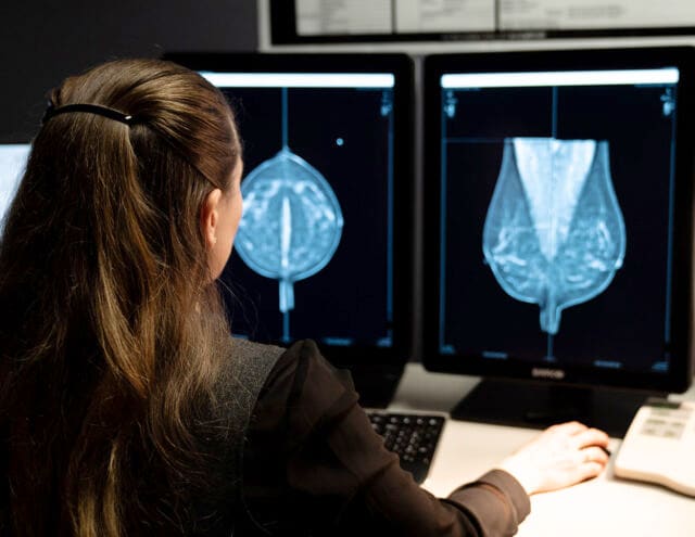 Breast Cancer Research