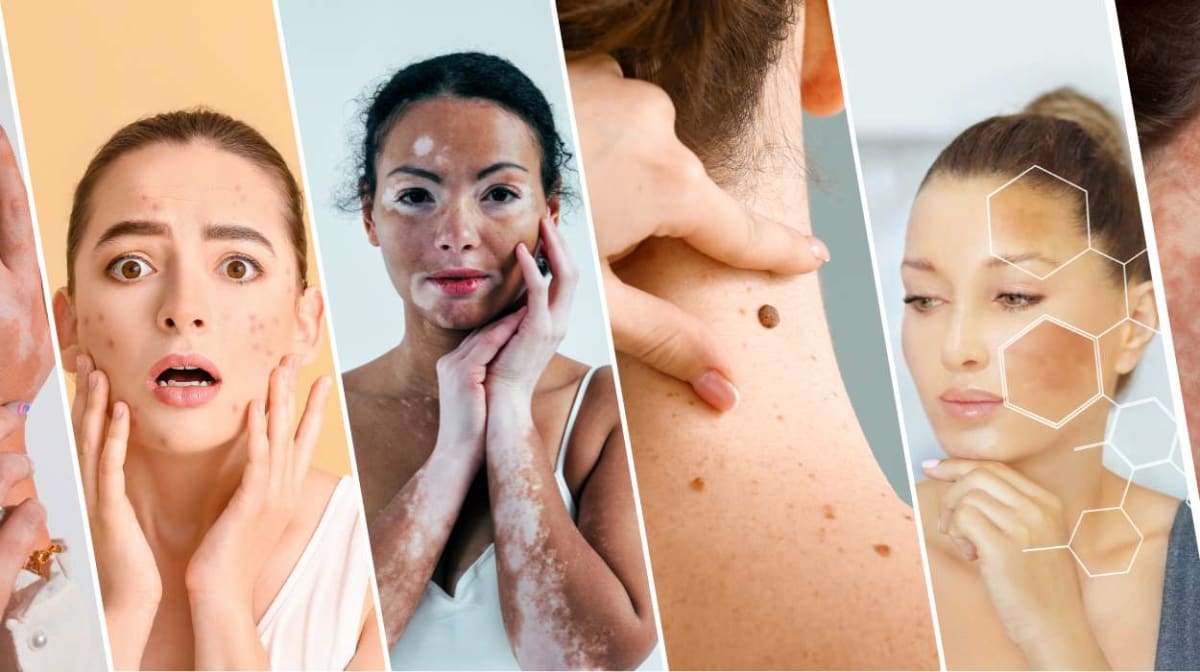 Top Skin Concerns Examples and How to Address Them Naturally in 2025 Top Skin Concerns Examples and How to Address Them Naturally in 2025