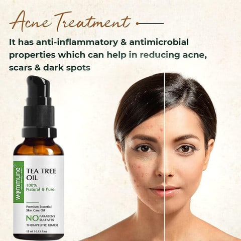 Natural Acne Remedies: Beyond Tea Tree Oil for Clearer Skin Natural Acne Remedies: Beyond Tea Tree Oil for Clearer Skin