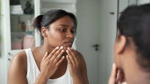 My Hormonal Skin Hated These 10 Mistakes—Here's What Worked