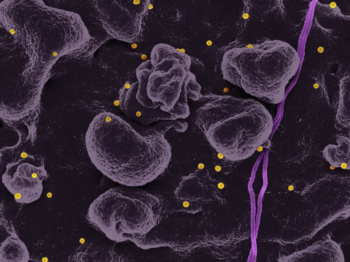 Microbial community interaction diagram