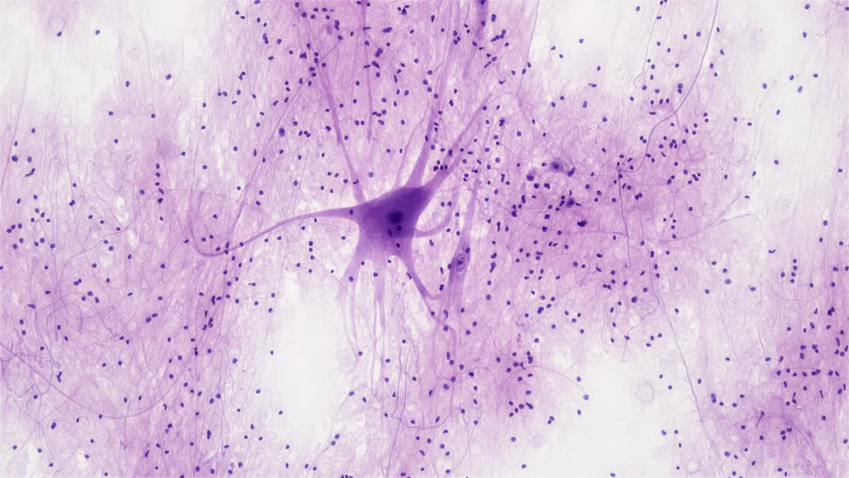 microscopic view of neural networks and bio-chips