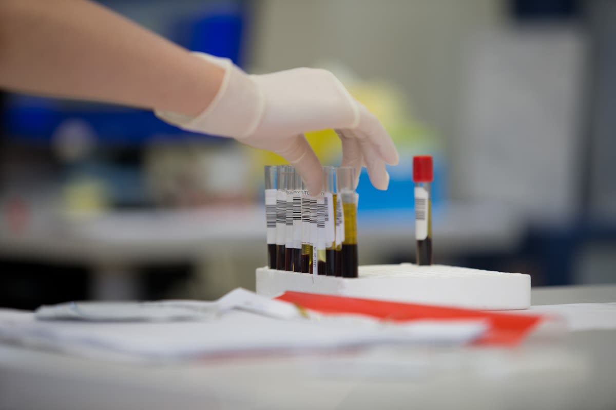 Centenarian blood biomarker analysis concept