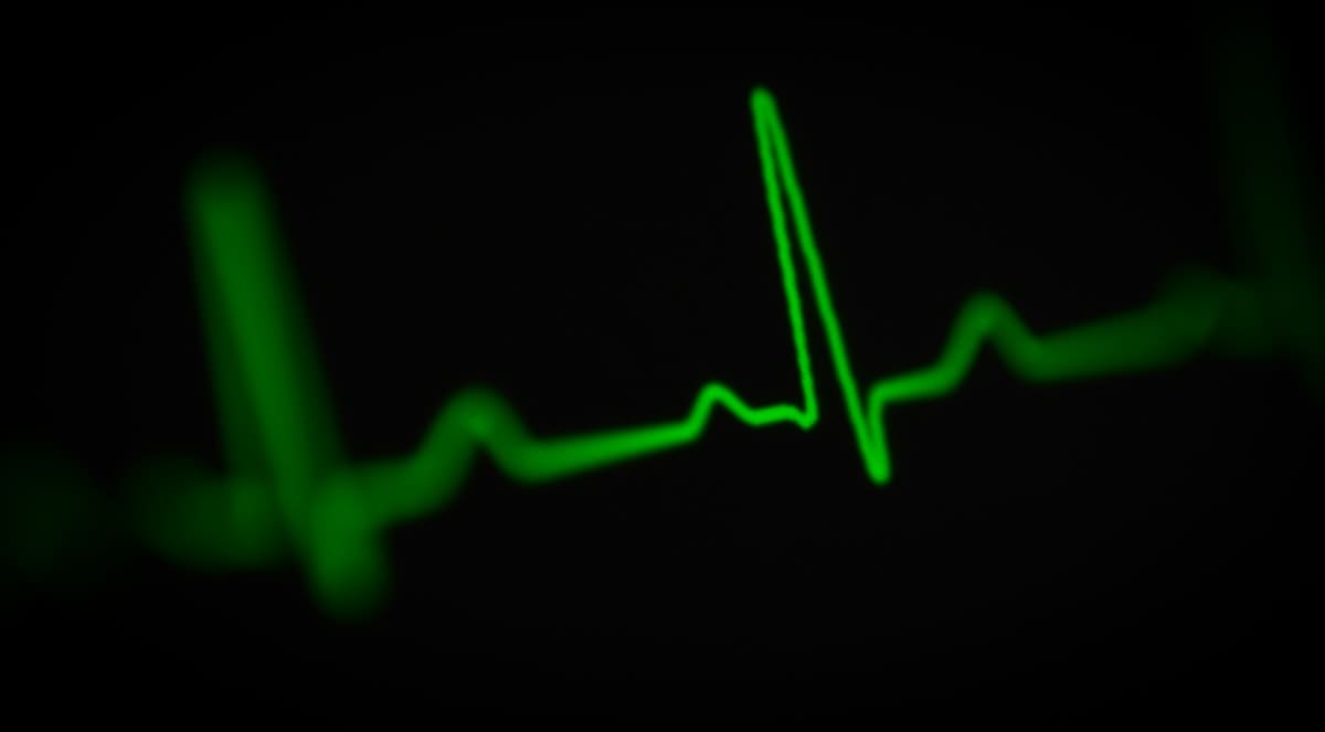 Heart rate variability waveform graph