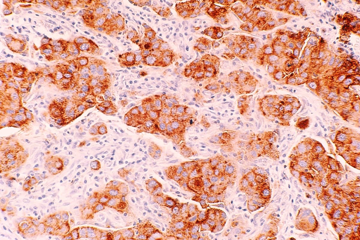 Microscopic view of endocrine glands and hormones