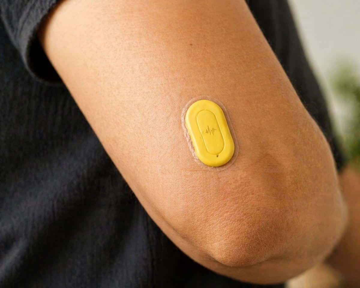 Close up of a health tracking device on an arm