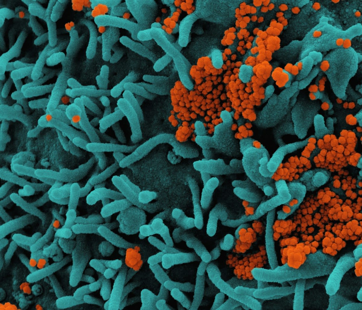 Microscopic view of soil microbes