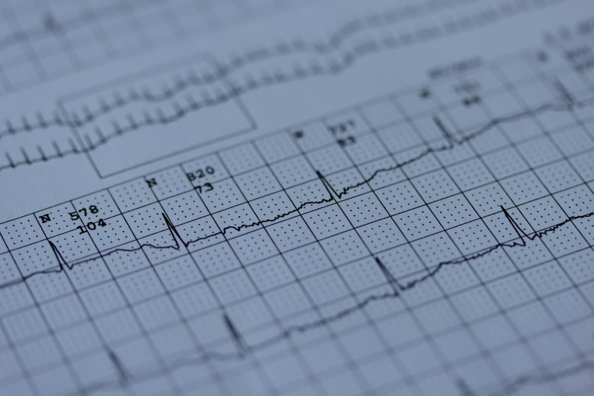 Ultradian rhythm cycle chart