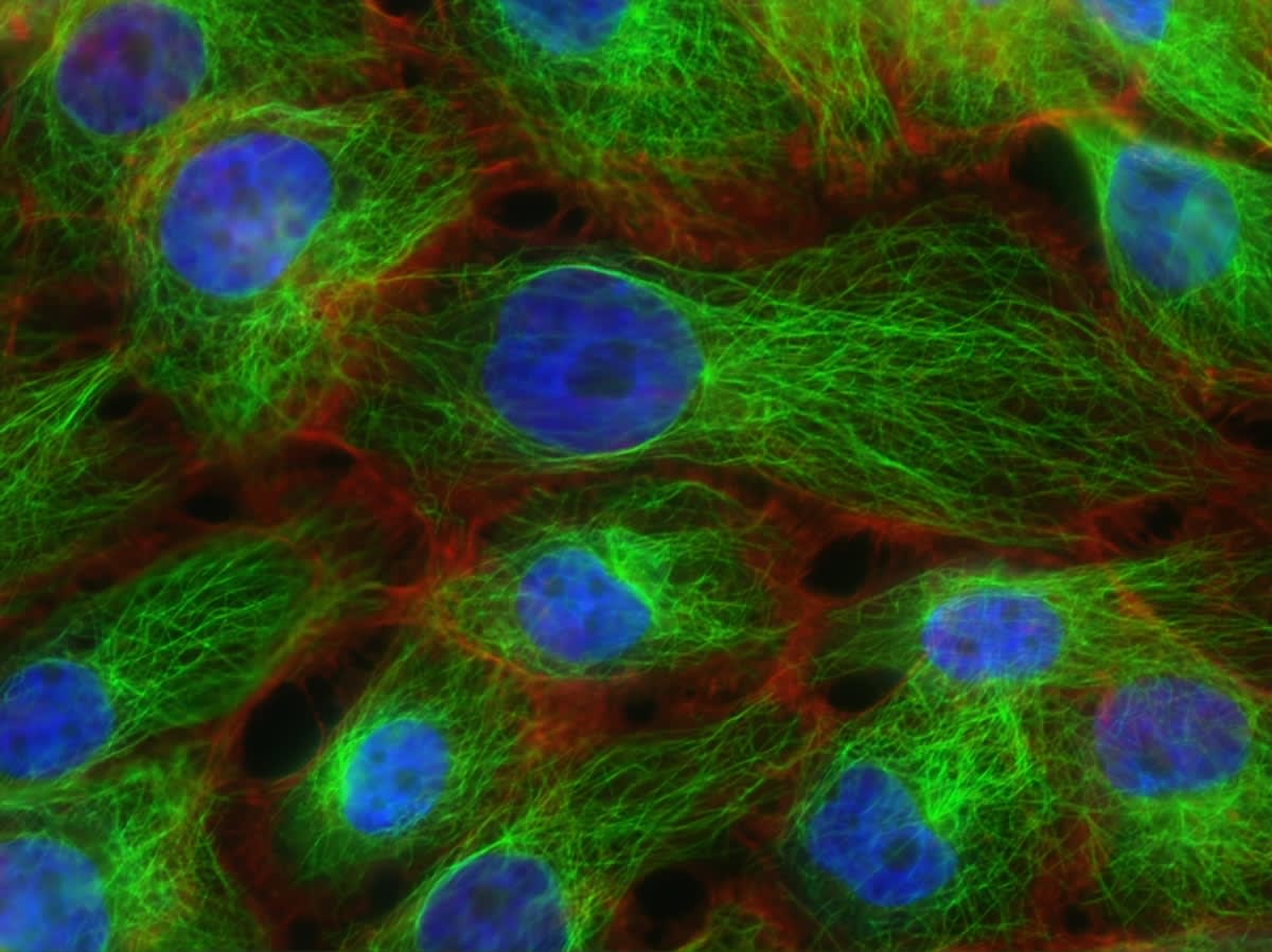 Microscopic view of mitochondria in a cell