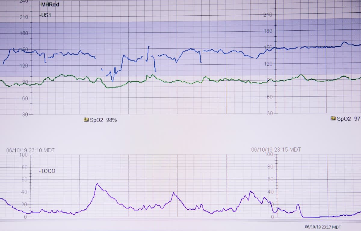 Blood glucose graph showing a spike and a crash
