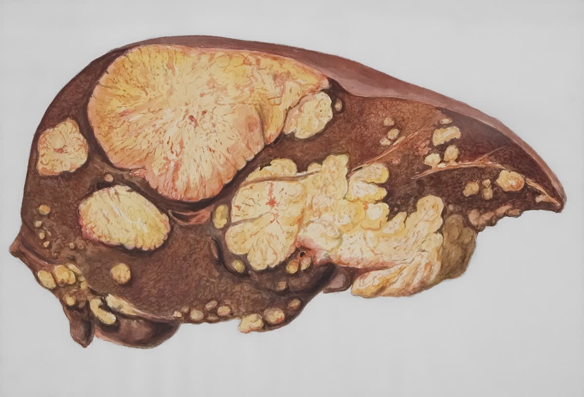 Diagram of the liver's metabolic pathways
