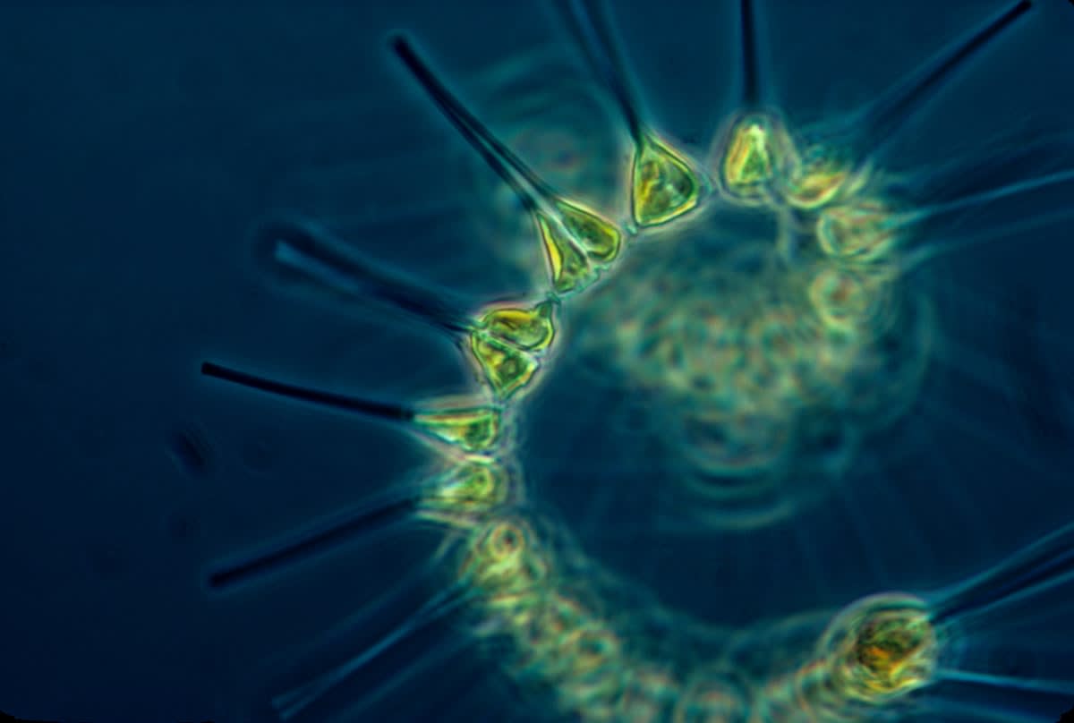 Microscopic view of yeast or bacteria cells