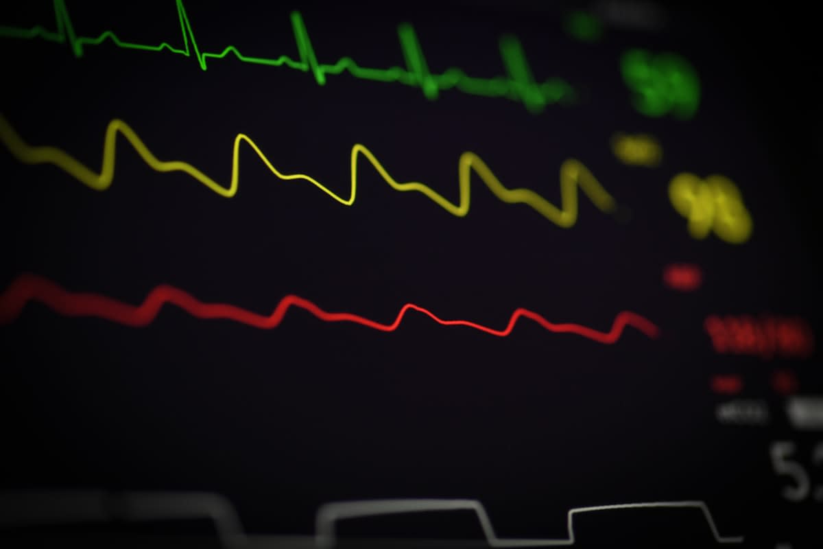 Close up of a modern health wearable showing heart rate variability graphs