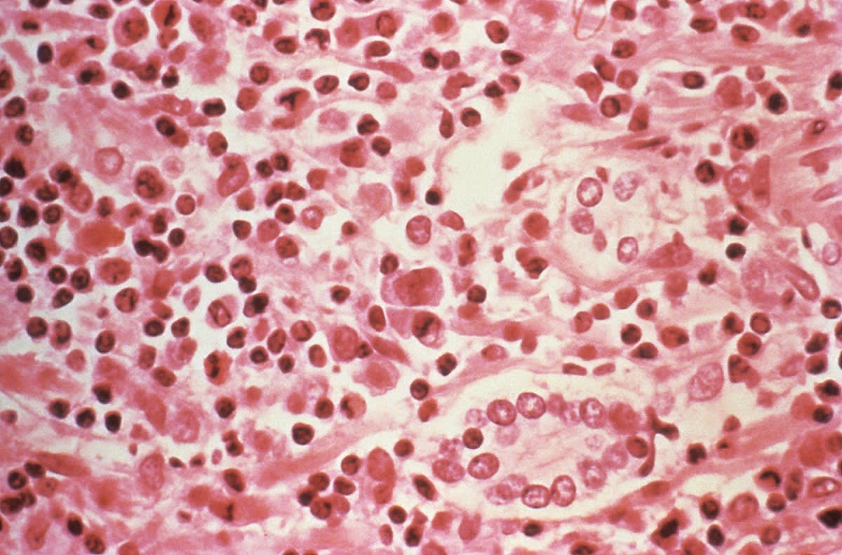 Microscopic view of circadian clock proteins in liver cells