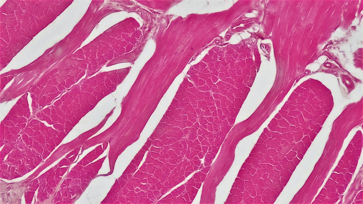 muscle atrophy cross section