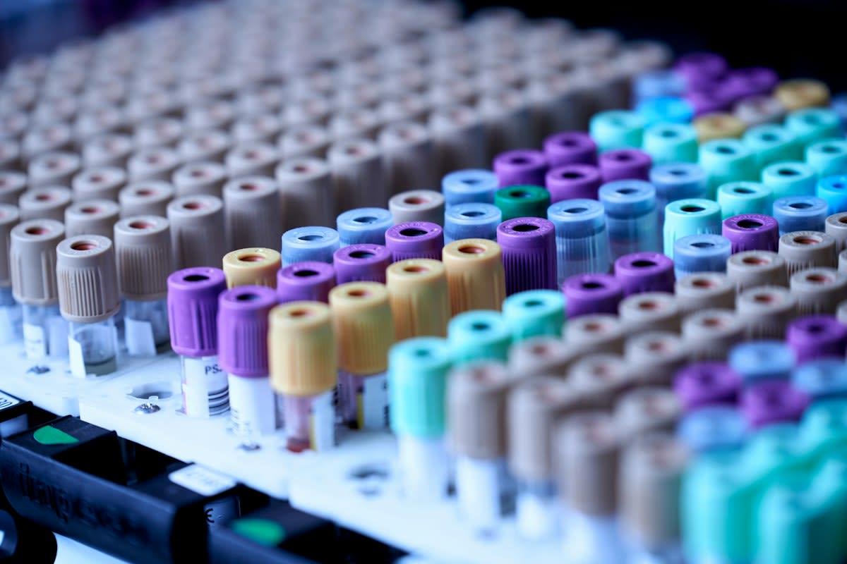 Laboratory blood sample analysis