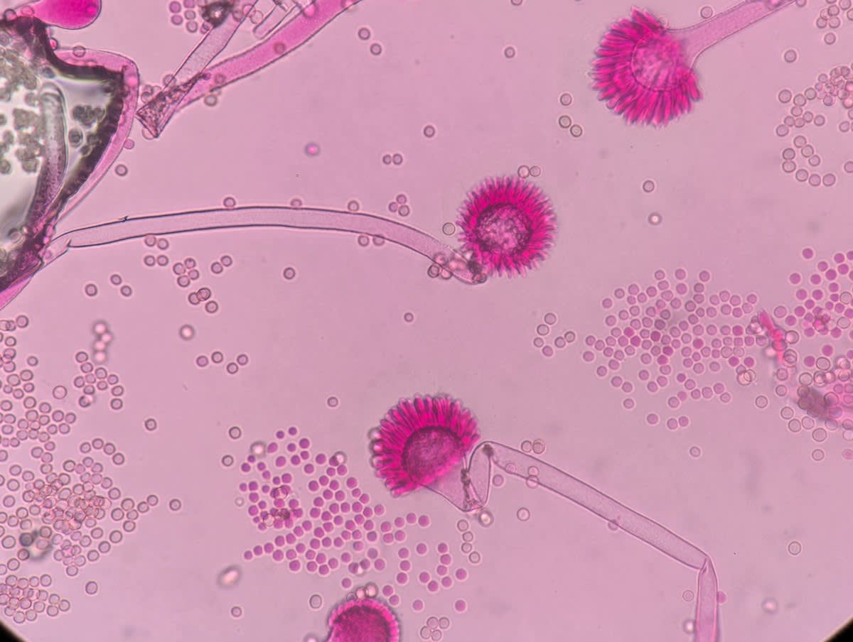 Microscopic view of pollen grains