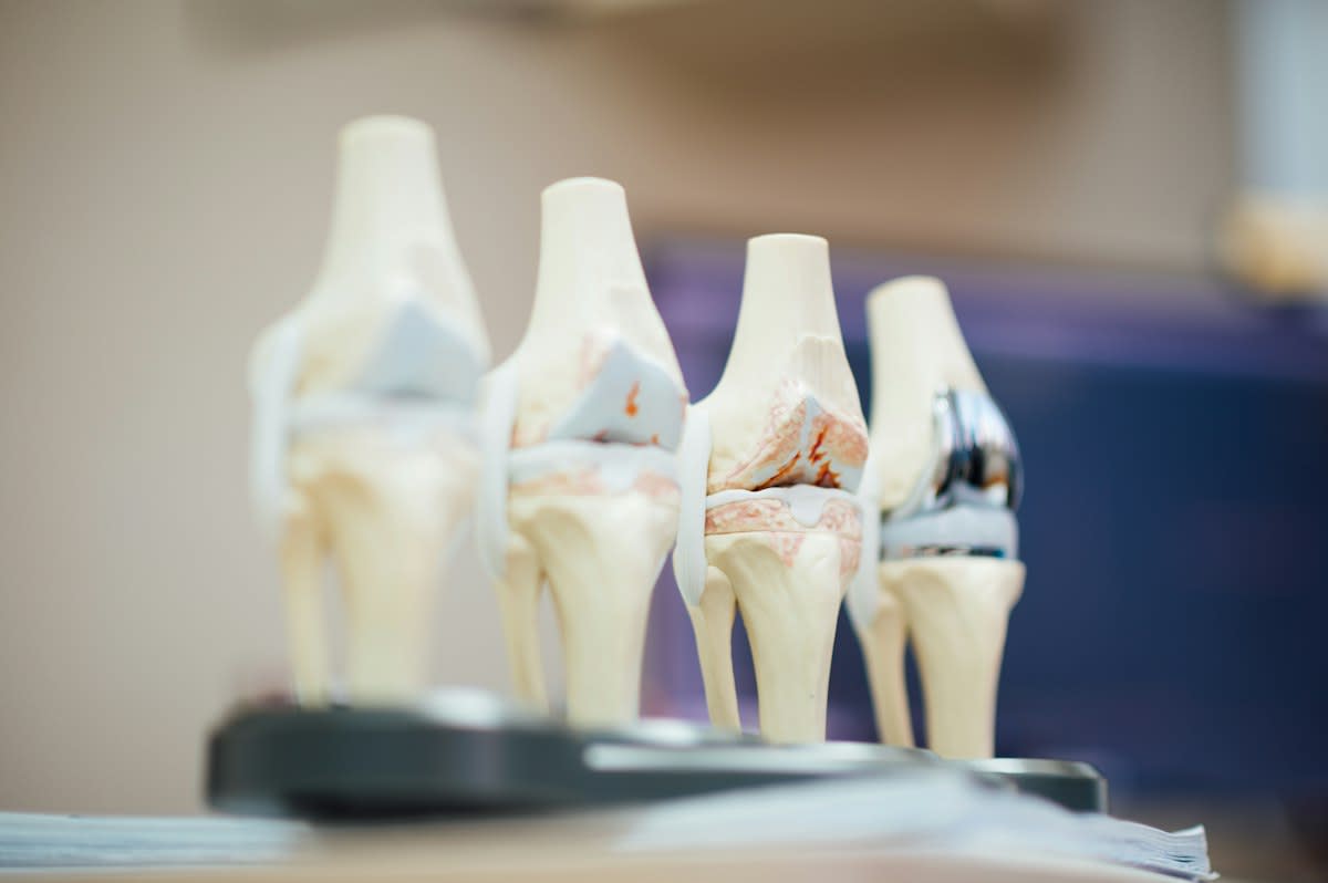 Close up of a knee joint anatomical model