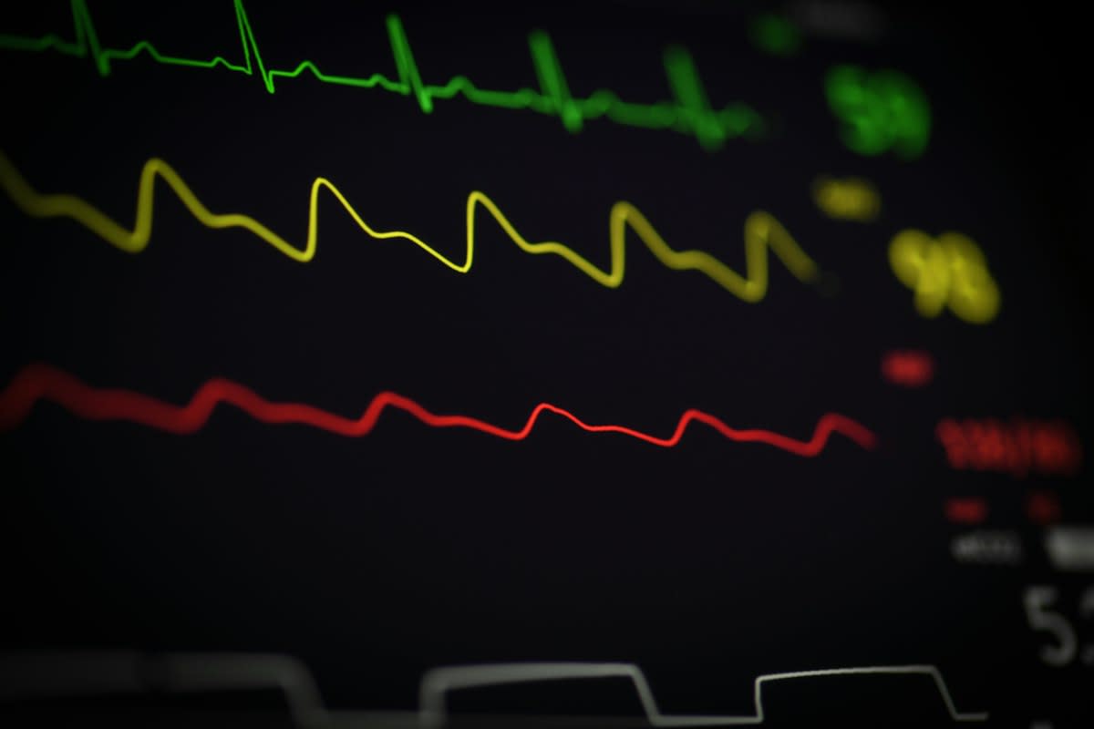 close up of a medical glucose monitor screen with a jagged line graph