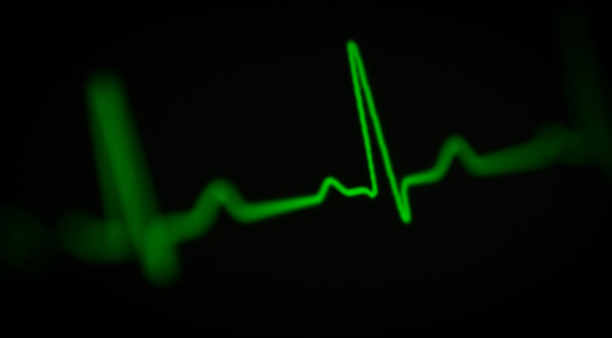 heart rate variability graph