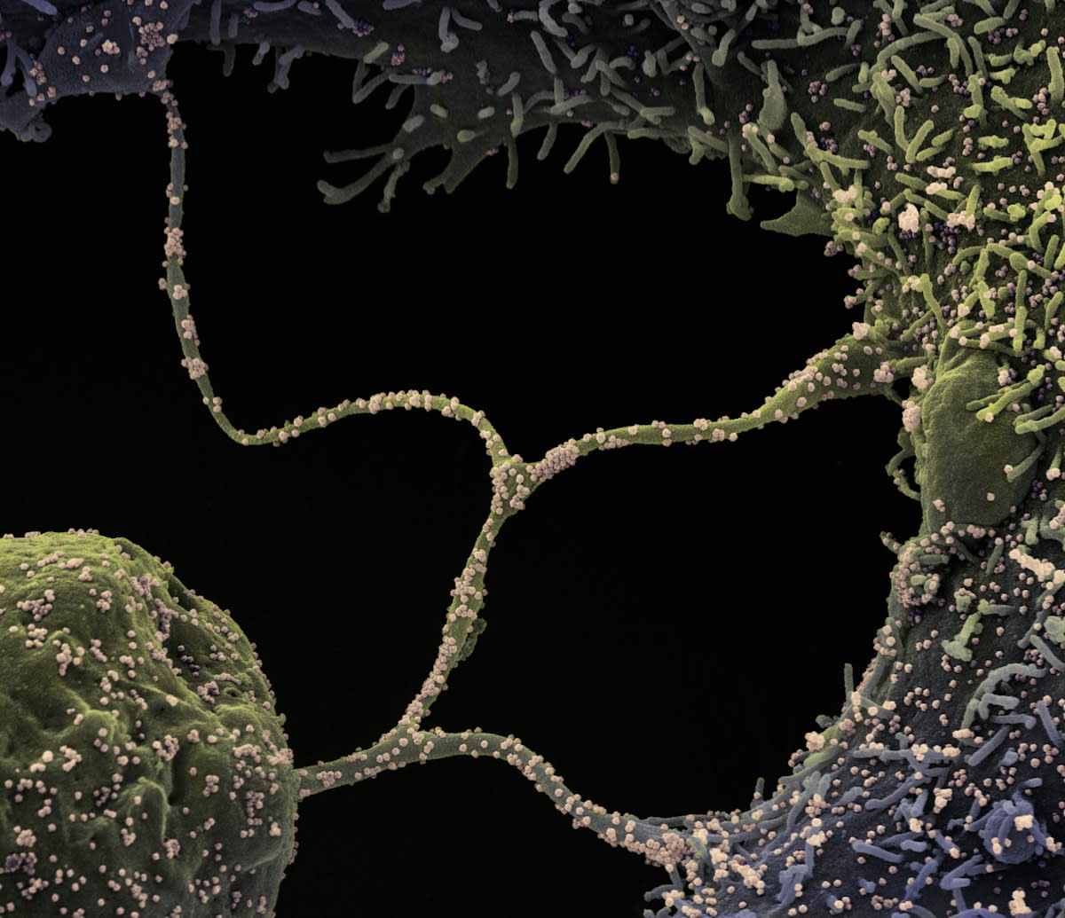Cellular senescence and mTOR pathway diagram