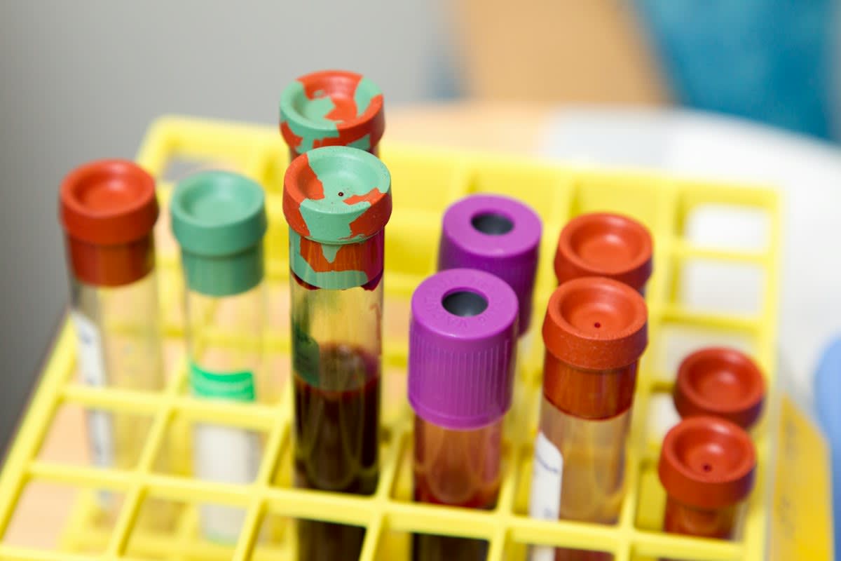 Medical professional analyzing blood samples