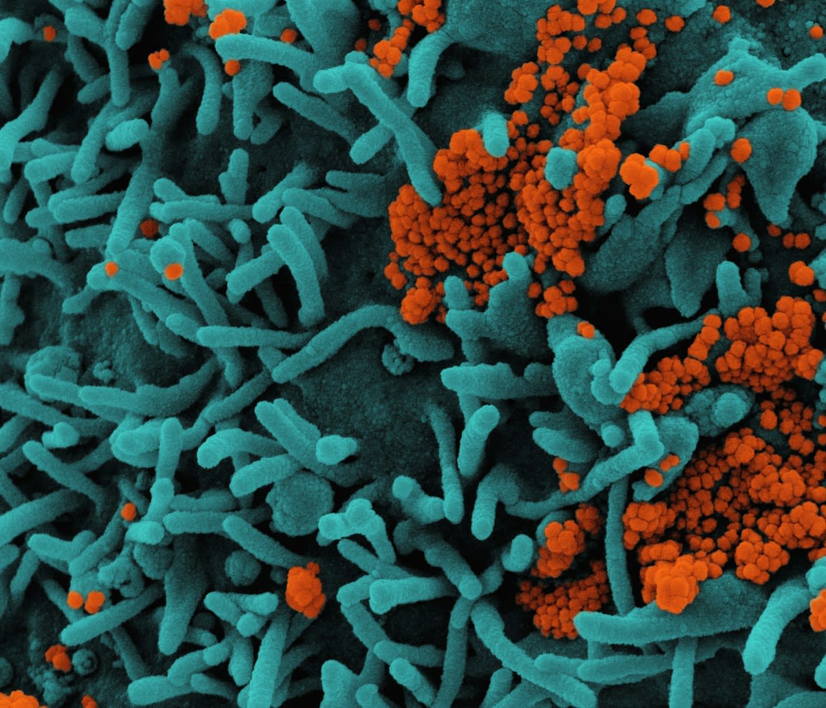 Microscopic view of gut bacteria