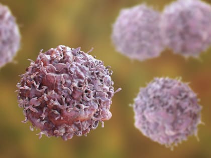 Онколог Азизова перечислила основные причины рака