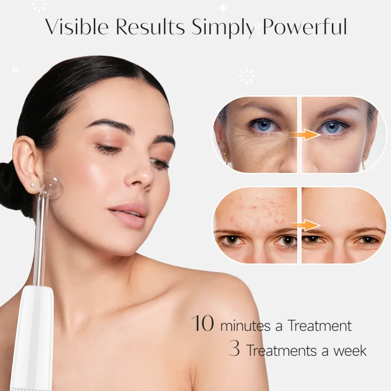 ARSONVAL Blue 6-in-1High Frequency Facial Machine - image 2