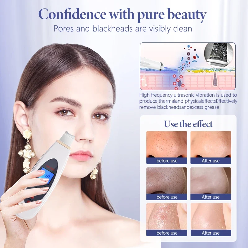 Ultrasonic Skin Scrubber Deep Face Cleaning - image 2