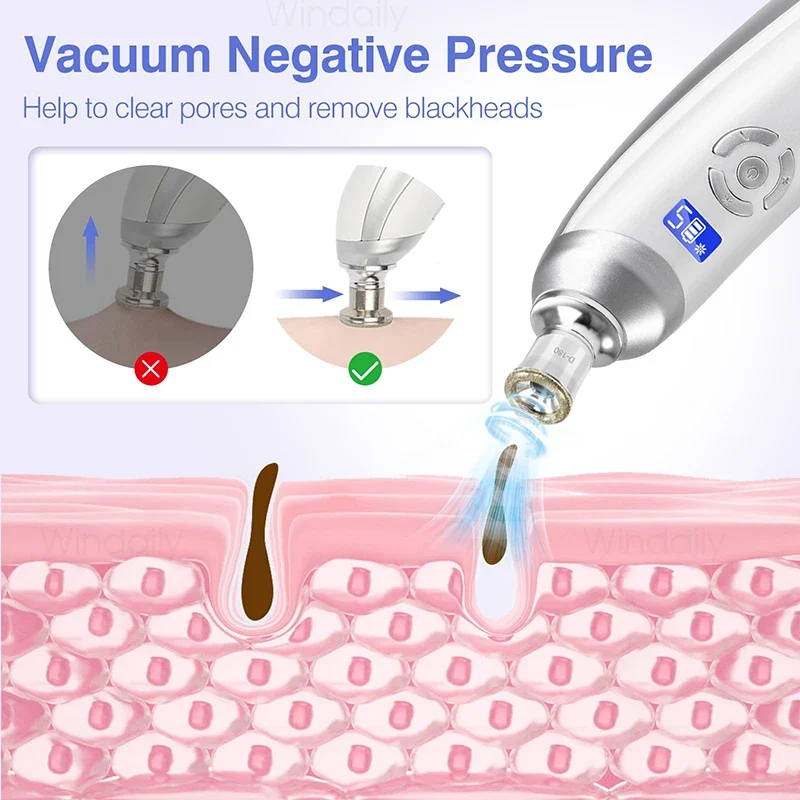 Machine Blackhead Remover Vacuum Pore Cleaner - image 3