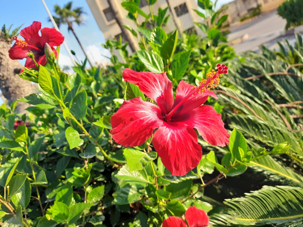 "بعض الندبات لا يمكن رؤيتها" تصويرى من (أبو قير)